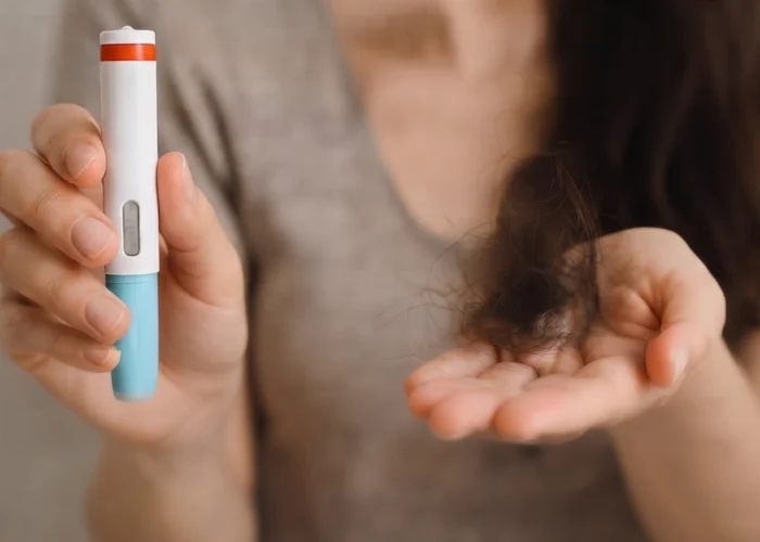 Do Weight Loss Injections Cause Hair Loss?