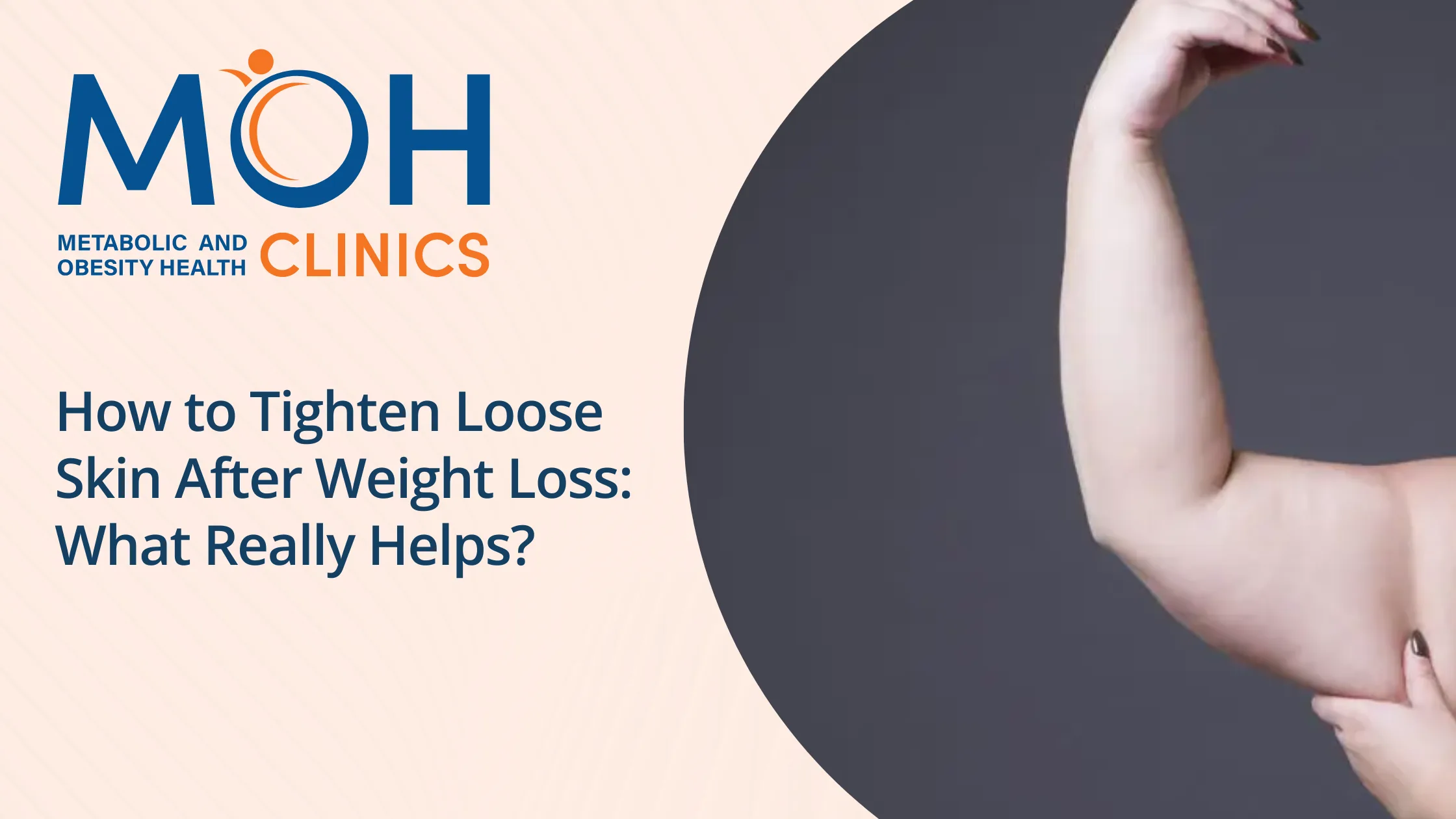 How to Tighten Loose Skin After Weight Loss: What Really Helps?