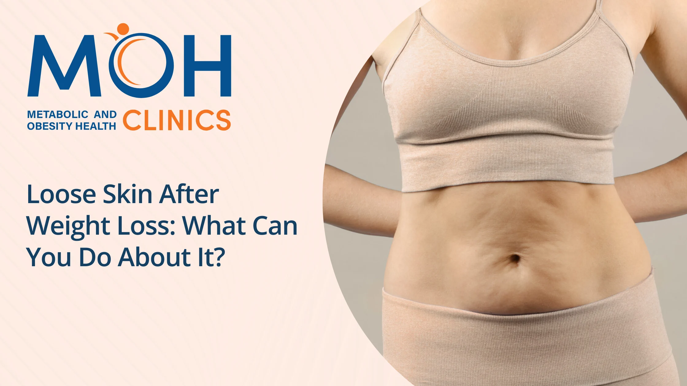 Loose Skin After Weight Loss: What Can You Do About It ?