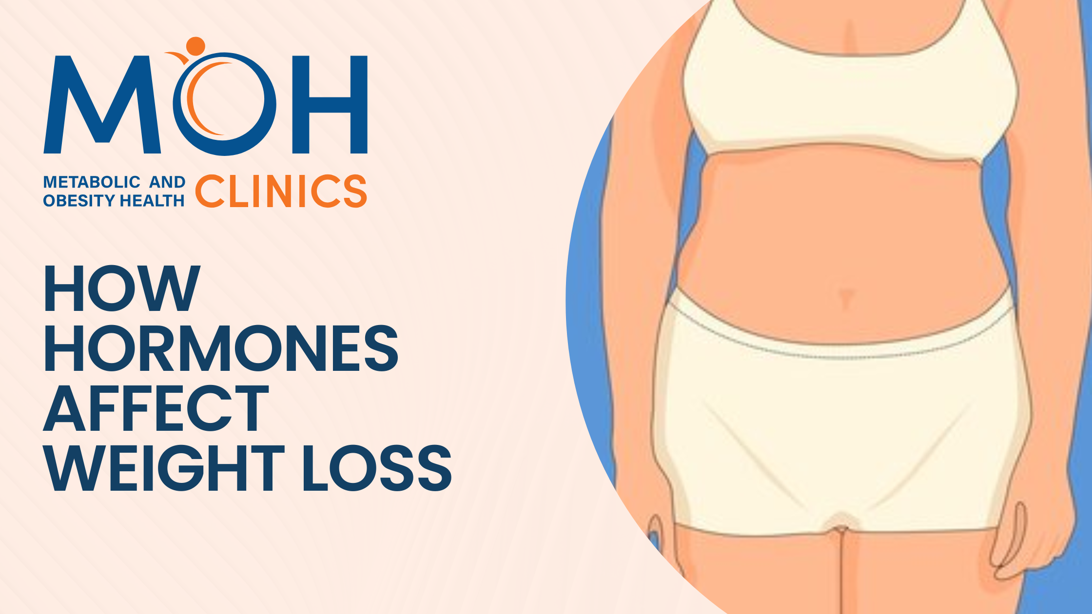 How Hormones Affect Weight Loss: Why Diet Alone May Not Work