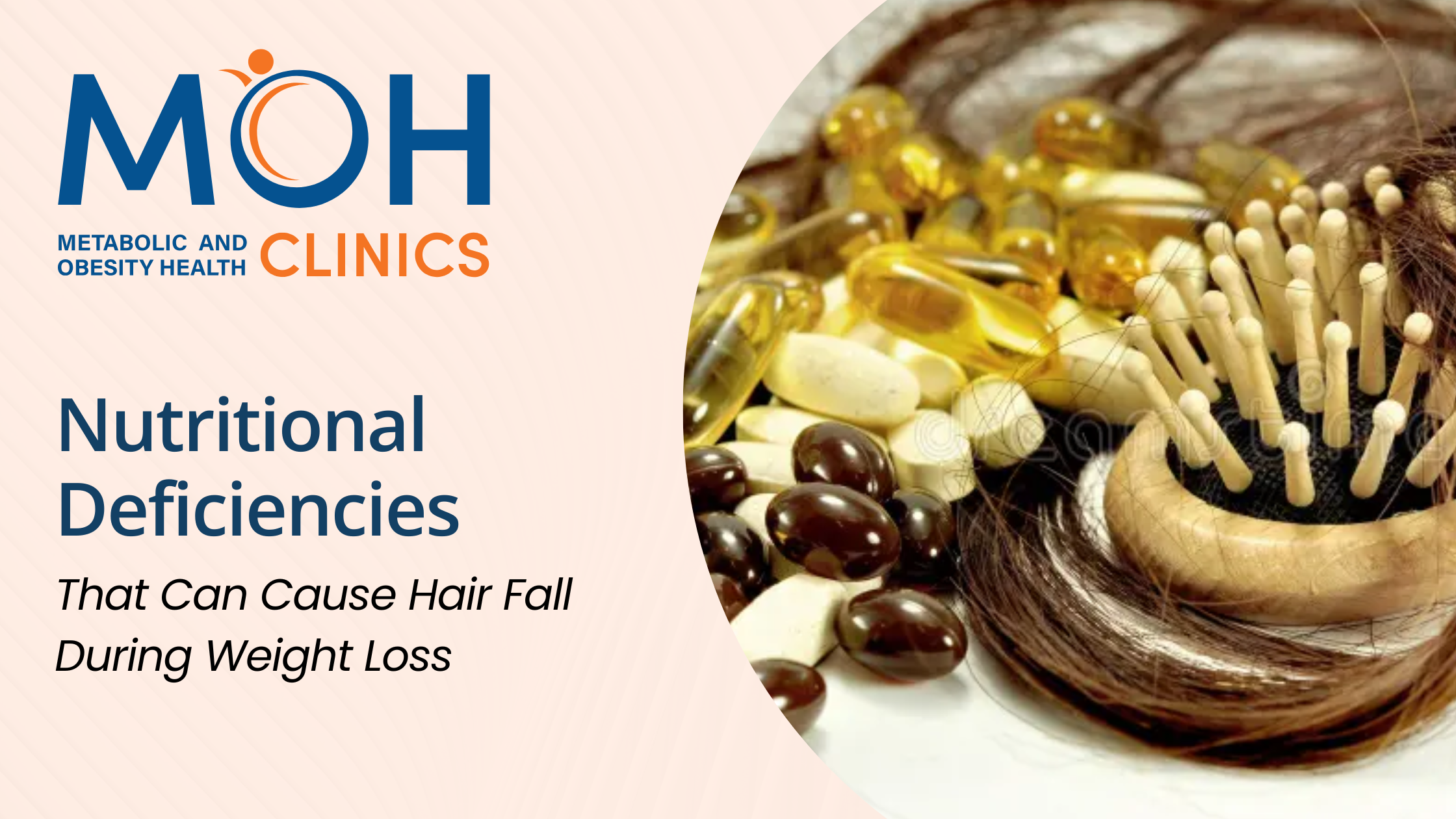 Nutritional Deficiencies That Can Cause Hair Fall During Weight Loss