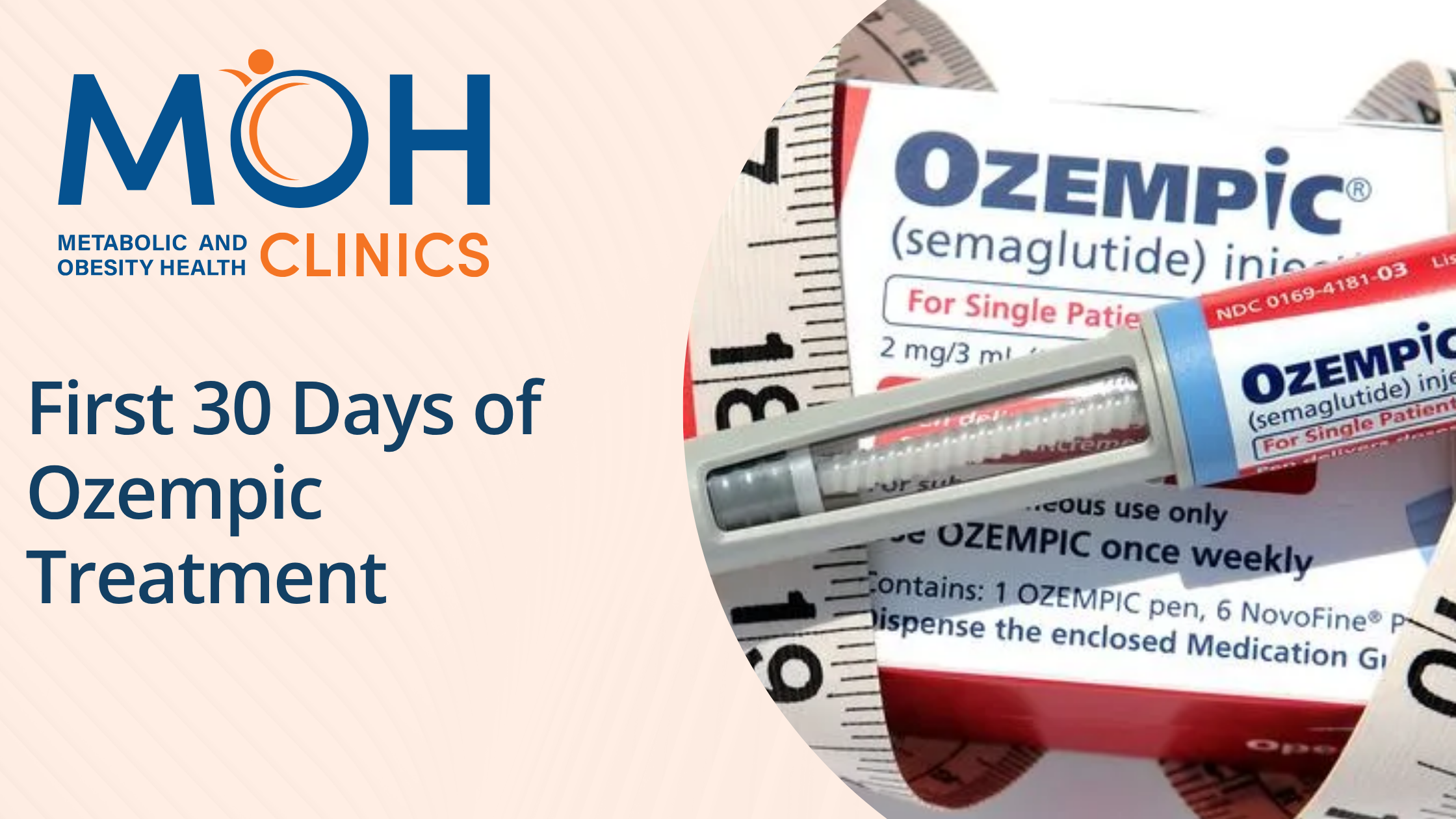 What Happens in the First 30 Days of Ozempic Treatment?